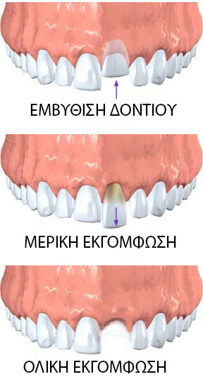 teeth injuries